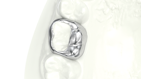 With occlusal pad