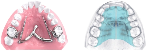 Combined with orthodontic device