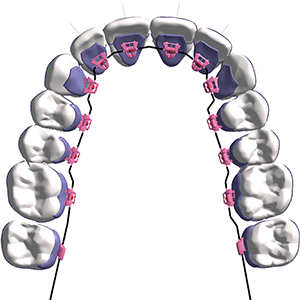 Passive at the beginning of treatment