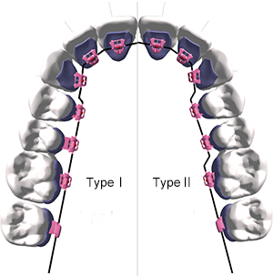 Passive at the beginning of treatment