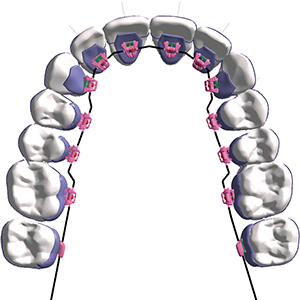 Passive at the beginning of treatment