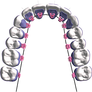 Passive at the beginning of treatment